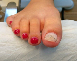 TRAINING ORTOGRIP professional, 1 person