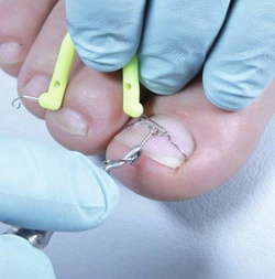 TRAINING ORTOGRIP professional, 1 person