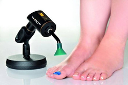 Fotodynamiczna terapia PACT® MED przeciw grzybicy paznokci